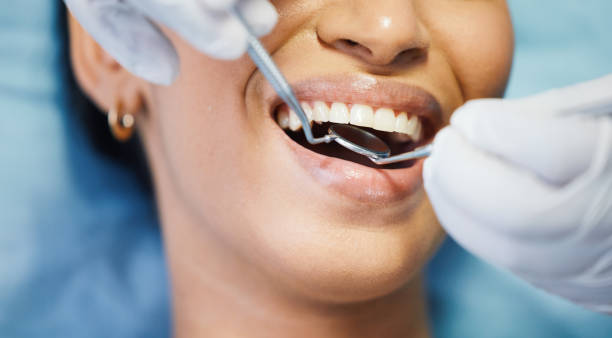 Best Emergency Treatment for Dental Infections or Abscesses in Sweetwater, TN
